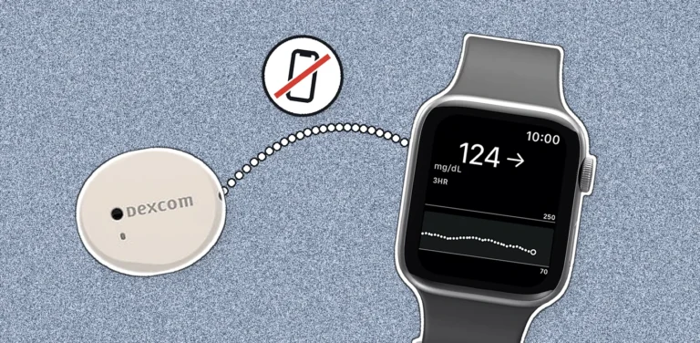 Dexcom Direct to Watch